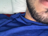 Fimose_3